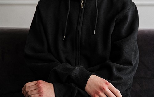 teenager in a black hoody with bruised and bloody knuckles